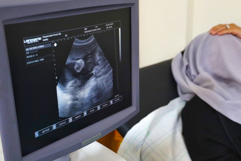 دراسة تكشف استمرار النشاط البيولوجي للمبايض بعد انقطاع الطمث